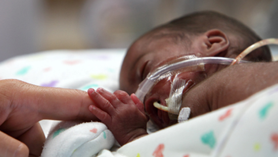 Non-Invasive Support In Neonatal Respiratory Distress | Clinical View